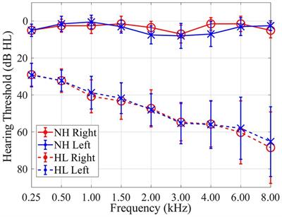 Head-orienting behaviors during simultaneous speech detection and localization